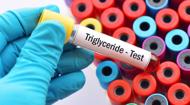 Triglyceride test
