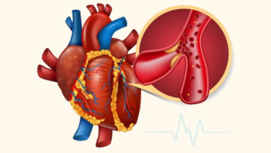 triglycerides