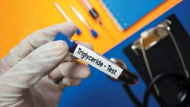 triglyceride test