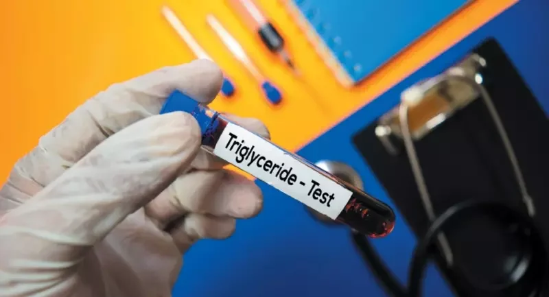 triglyceride test