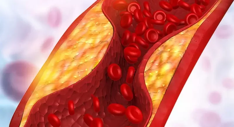 triglyceride test what is